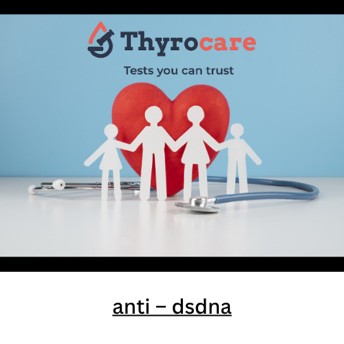 anti - dsdna