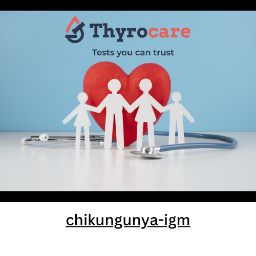 chikungunya-igm